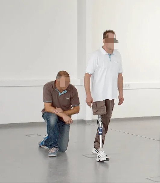 假肢---重新學(xué)習(xí)走路