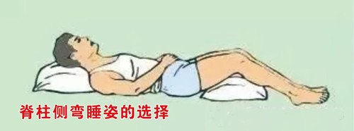 睡姿不正確會對脊柱側(cè)彎產(chǎn)生影響嗎？
